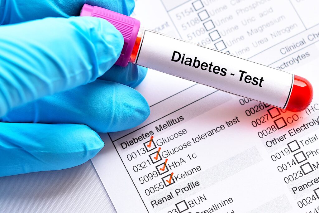 Blood Sugar Levels understanding for all